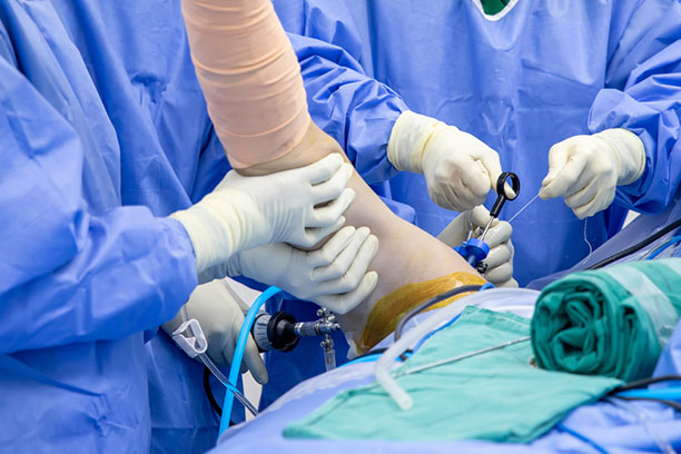 Knee & Shoulder Arthroscopy Myths